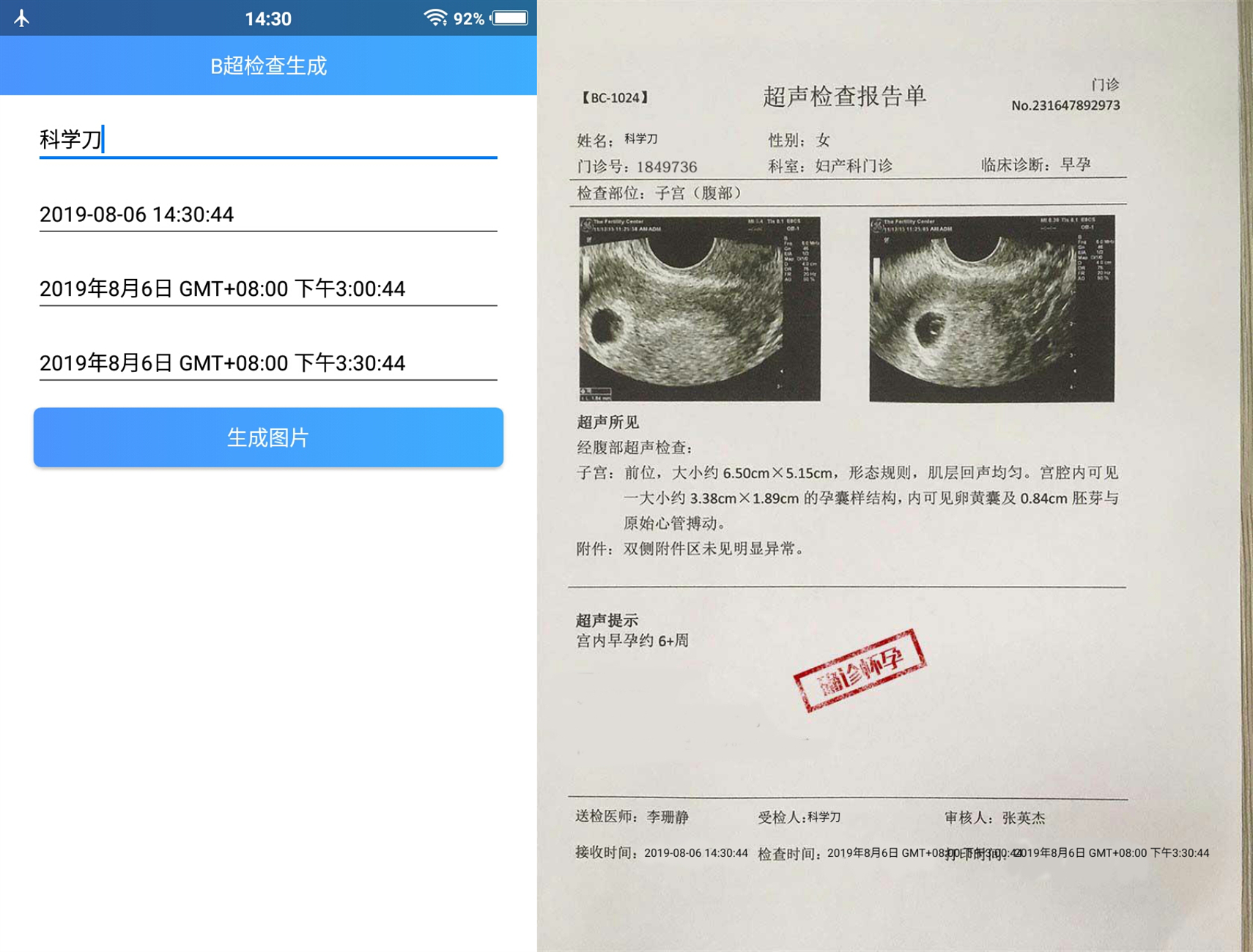 安卓怀孕恶搞b超检查生成器